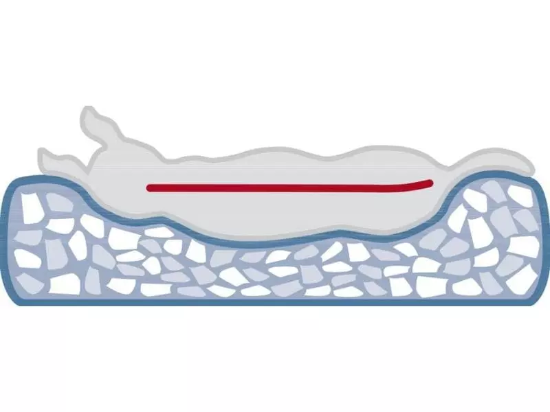 Trixie Hunde-Kissen Vital Calito 70 x 50 cm 4 Trixie Hunde-Kissen Vital Calito 70 x 50 cm - Image 4