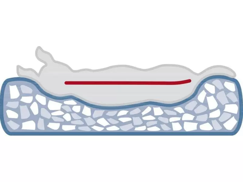 Trixie Hunde-Bett Vital Calito 100 x 75 cm 5 Trixie Hunde-Bett Vital Calito 100 x 75 cm - Image 5